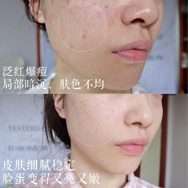 彩神vll对男人祛魅是30岁送我最好的礼物(图4)