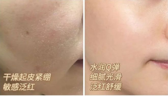 彩神vll对男人祛魅是30岁送我最好的礼物(图20)